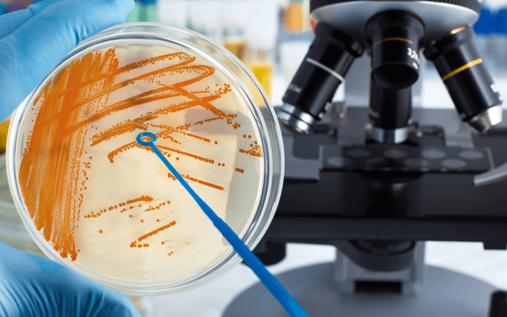 Микробиология и основы бактериологии